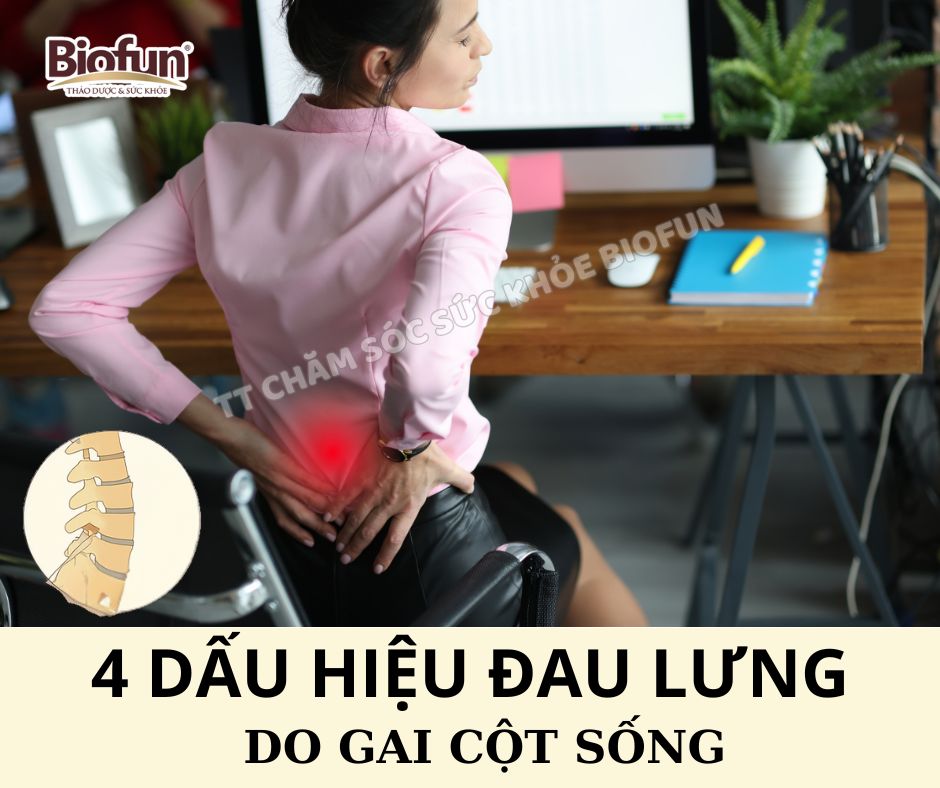 4 Dấu Hiệu Đau Lưng Do Gai Cột Sống và Giải Pháp Tự Nhiên Từ Biofun