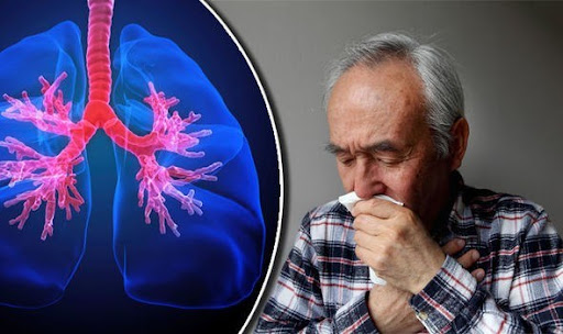 BỆNH PHỔI TẮC NGHẼN MẠN TÍNH (COPD) CÓ CHỮA ĐƯỢC KHÔNG? PHƯƠNG PHÁP ĐIỀU TRỊ HIỆU QUẢ
