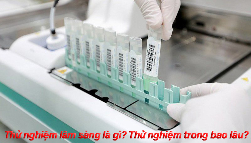 Thử nghiệm lâm sàng là gì? Thời gian thử nghiệm lâm sàng bao lâu?